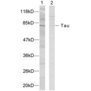 Western blot analysis of extracts using Tau (epitope around residue 235) Antibody (abx012886). Line1: K562 cells; Line2: COLO205 cells.