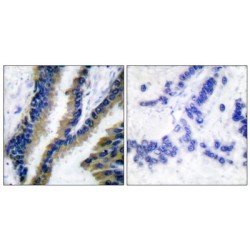 Proto-Oncogene Vav (VAV1) Antibody