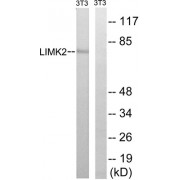 Western blot analysis of extracts from 3T3 cells, treated with PMA (125ng/ml, 30mins), using LIMK2 (epitope around residue 283) antibody.