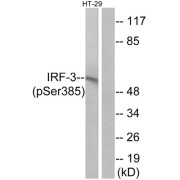 Tyrosine-Protein Phosphatase Non-Receptor Type 6 (PTPN6) Antibody