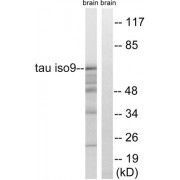 Western blot analysis of extracts from rat brain cells, using Tau (epitope around residue 717/400) antibody.
