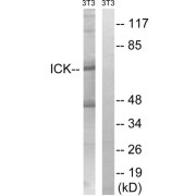 Western blot analysis of extracts from 3T3 cells, treated with PBS (10uM, 60mins), using ICK (epitope around residue 159) antibody.