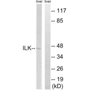 Western blot analysis of extracts from rat liver cells, using ILK (epitope around residue 246) antibody.