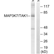 Western blot analysis of extracts from Jurkat cells, treated with heat shock, using MAP3K7 (epitope around residue 187) antibody.