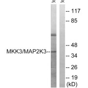 Western blot analysis of extracts from Jurkat cells, treated with serum (20%, 15mins), using MAP2K3 (epitope around residue 222) antibody.