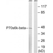Western blot analysis of extracts from 293 cells, using p70 S6 Kinase beta (epitope around residue 423) antibody.