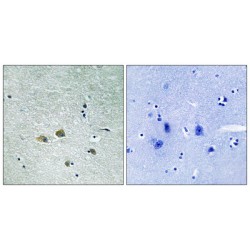 Serine/threonine-Protein Kinase PAK 1 (PAK1) Antibody