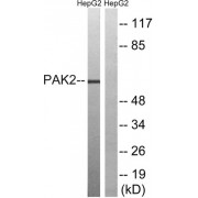 Western blot analysis of extracts from HepG2 cells, treated with serum (20%, 15mins), using PAK2 (epitope around residue 192) antibody.