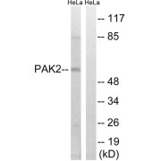 Western blot analysis of extracts from HeLa cells, treated with TSA (400nM, 24hours), using PAK2 (epitope around residue 141) antibody.