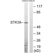 Western blot analysis of extracts from COLO cells, using STK39 (epitope around residue 311) antibody.