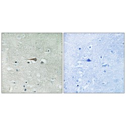 Dual Specificity Protein Kinase TTK (TTK) Antibody