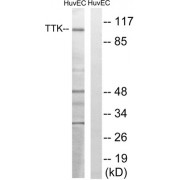 Western blot analysis of extracts from HUVEC cells, treated with etoposide (25uM, 24hours), using TTK (epitope around residue 676) antibody.