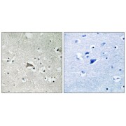 Immunohistochemistry analysis of paraffin-embedded human brain tissue, using VEGFR1 antibody.