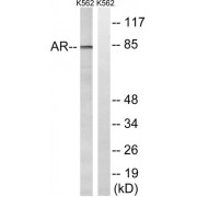 Western blot analysis of extracts from K562 cells, treated with EGF (200ng/ml, 5mins), using Androgen Receptor (epitope around residue 363) antibody.