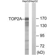 Western blot analysis of extracts from HepG2 cells, using TOP2A (epitope around residue 1343) antibody.