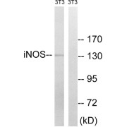 Western blot analysis of extracts from 3T3 cells, using NOS2 (epitope around residue 151) antibody.