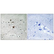 abx012953