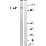Western blot analysis of extracts from mouse brain cells, using ITCH (epitope around residue 420) antibody.