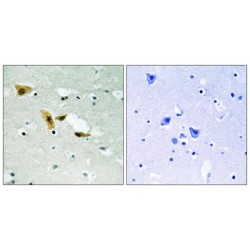 Aprataxin And PNKP Like Factor (APLF) Antibody