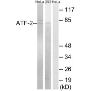 Western blot analysis of extracts from HeLa cells and 293 cells, using ATF2 (epitope around residue 472) antibody.