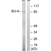 Western blot analysis of extracts from 293 cells, using Bcl-6 (epitope around residue 333) antibody.