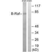 Western blot analysis of extracts from rat brain cells, using B-Raf (epitope around residue 753) antibody.
