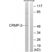 Western blot analysis of extracts from HT-29 cells, treated with heat shock, using CRMP2 (epitope around residue 509) antibody.