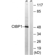 Western blot analysis of extracts from Jurkat cells, using CtBP1 (epitope around residue 422) antibody.
