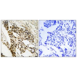 MAP Kinase-Activated Protein Kinase 2 (MAPKAPK2) Antibody