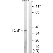 Western blot analysis of extracts from HT-29 cells, treated with serum (20%, 15mins), using TOB1 (epitope around residue 164) antibody.