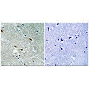 Immunohistochemistry analysis of paraffin-embedded human brain tissue using 53BP1 antibody.