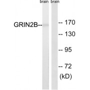 Western blot analysis of extracts from mouse brain cells, using GRIN2B (epitope around residue 1303) antibody.