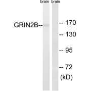 Western blot analysis of extracts from mouse brain cells, using GRIN2B (epitope around residue 1303) antibody.