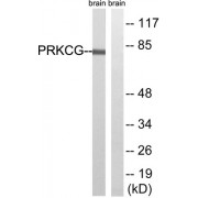 Western blot analysis of extracts from Rat brain cells, using PRKCG (epitope around residue 655) antibody.
