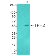 Western blot analysis of extracts from HuvEc cells (Lane 2), using TPH2 (epitope around residue 19) Antibody. The lane on the left is treated with synthesized peptide.