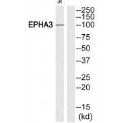 Western blot analysis of extracts from Jurkat cells, using EPHA3 (epitope around residue 602) antibody.