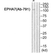 Western blot analysis of extracts from JK cells, using EPHA7 (epitope around residue 791) antibody.