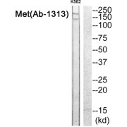 Western blot analysis of extracts from K562 cells, using Met (epitope around residue 1313) antibody.