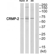 Western blot analysis of extracts from HepG2 cells, Jurkatcells and 293 cells, using CRMP2 (epitope around residue 522) antibody.