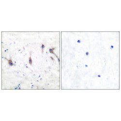 Nucleolar Protein 3 (NOL3) Antibody