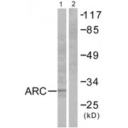 Western blot analysis of extracts from HeLa cells, using NOL3/ARC antibody. The lane on the right is blocked with the synthesized peptide.