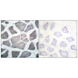 Bcl-2 Homologous Antagonist/Killer (BAK1) Antibody