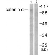 Western blot analysis of extracts from HeLa cells, using Catenin- alpha antibody.