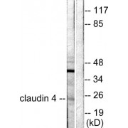 Western blot analysis of extracts from HeLa cells, using Claudin 4 antibody (abx013032).