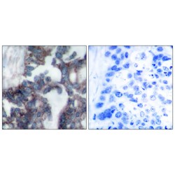 Claudin 1 (CLDN1) Antibody