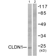 Western blot analysis of extracts from HeLa cells, using Claudin 1 antibody (abx013033).