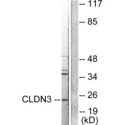 Western blot analysis of extracts from HuvEc cells, using Claudin 3 antibody.