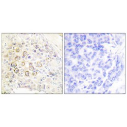 Receptor Tyrosine-Protein Kinase ErbB-3 (HER3) Antibody