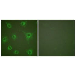 Collagen Type II (COL2) Antibody