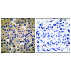 Collagen Type II (COL2) Antibody